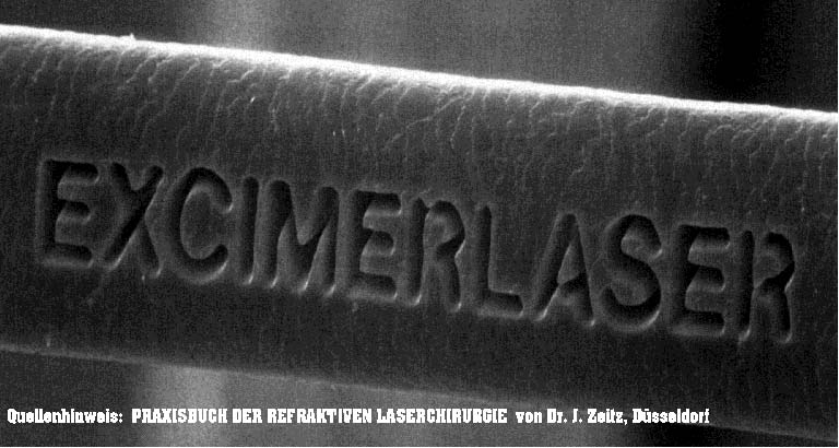 In ein menschliches Haar mit dem Excimerlaser eingraviert